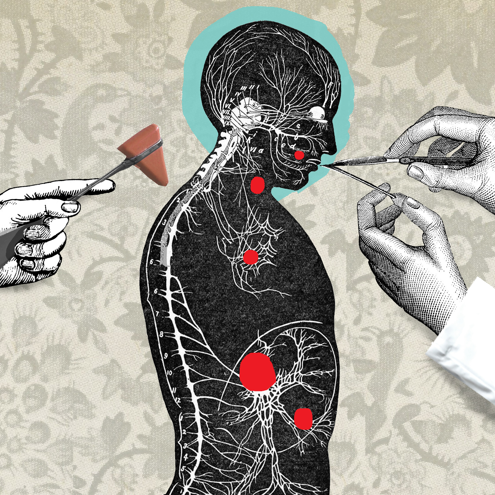 Could Depression Be Caused By An Infection?