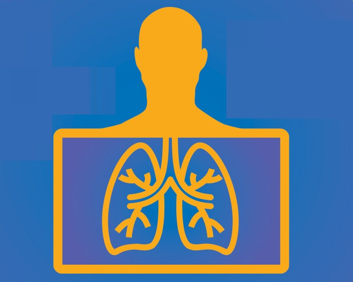 Orange graphic with blue background of person receiving lung xray