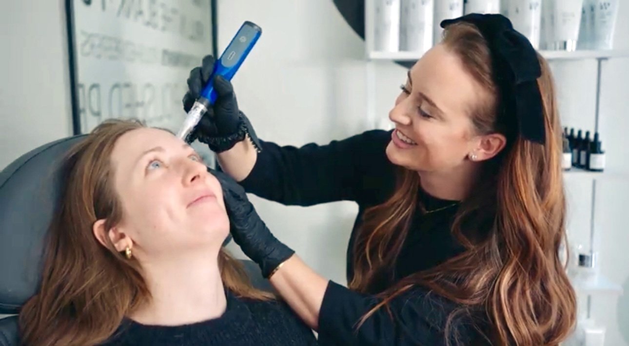 LexRx Microneedling
