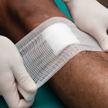 Infusion into arm